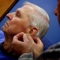 Free acupuncture available to Vermonters living with chronic pain